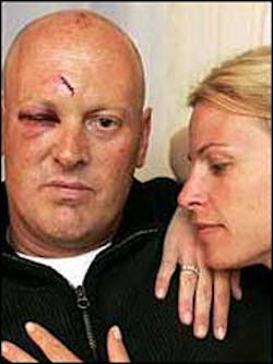 Fire Lt. Christopher Corwin, with his wife Liz, is recovering from a vicious beating. Fire Lt. Christopher Corwin, with his wife Liz, is recovering from a vicious beating.