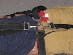 Figure 7: A head-on shot of our patient packaged in an RRS. Figure 7: A head-on shot of our patient packaged in an RRS.
