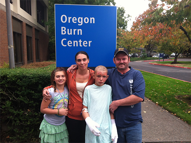 Seth Cutright, 12, is recovering from burns to his face and hands after carrying his grandmother to safety after an explosive fire at their home in Vernonia on Oct. 12.