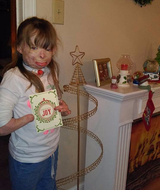 Safyre Terry was maimed in the 2013 fire that left her father and two siblings dead.