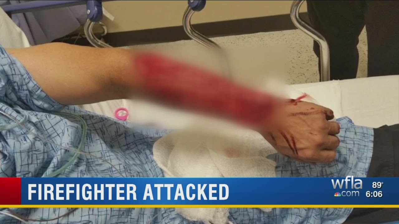 FF Mangled by Bite Pleas to Keep Attacker in Jail