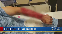 FF Mangled by Bite Pleas to Keep Attacker in Jail
