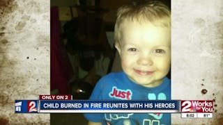 Tulsa OK Toddler Badly Burned Meets Hero Firefighters - Firefighter Video News | Firehouse