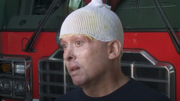 Injured Jefferson LA Firefighter Visits Station for First Time | Firehouse