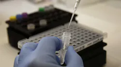 Brian Bowland, senior clinical lab specialist in microbiology in the UCLA Health System, is pipetting a master mix for testing of the COVID-19 coronavirus as the University of California's five medical centers are gearing up to expand their own in-house testing for the coronavirus in a move to bypass obstacles that have stymied a rapid response to the global pandemic.