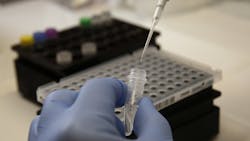 Brian Bowland, senior clinical lab specialist in microbiology in the UCLA Health System, is pipetting a master mix for testing of the COVID-19 coronavirus as the University of California's five medical centers are gearing up to expand their own in-house testing for the coronavirus in a move to bypass obstacles that have stymied a rapid response to the global pandemic. Brian Bowland, senior clinical lab specialist in microbiology in the UCLA Health System, is pipetting a master mix for testing of the COVID-19 coronavirus as the University of California's five medical centers are gearing up to expand their own in-house testing for the coronavirus in a move to bypass obstacles that have stymied a rapid response to the global pandemic.