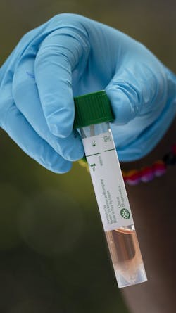 A test sample for COVID-19 for an 80-year-old man is headed to Quest Diagnostic after it was taken last week at a drive-through testing station at FoundCare in Palm Springs, FL. A test sample for COVID-19 for an 80-year-old man is headed to Quest Diagnostic after it was taken last week at a drive-through testing station at FoundCare in Palm Springs, FL.