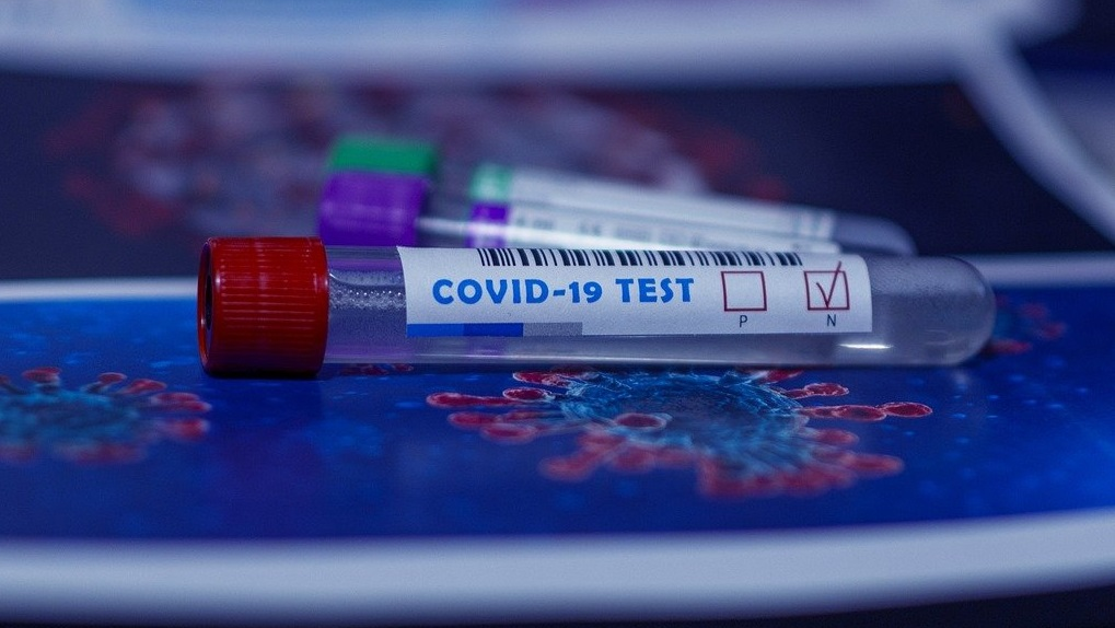 Covid 19 Test Pby 5fad6638d870c