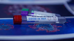 Covid 19 Test (pby)