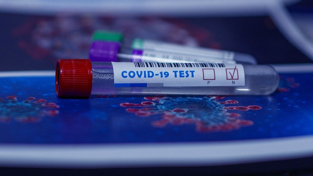 COVID-19 tests.