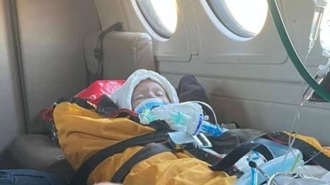The son of a first responder with First Medic Ambulance in Lison, ND, was severely burned after his mattress caught fire Tuesday.