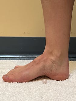 For arch lifts, slide the ball of your foot toward your heel by contracting the muscles that are on the bottom of your foot. Think of the exercise as if someone were trying to roll a marble underneath your foot while you keep your heel and the ball of your foot on the ground.
