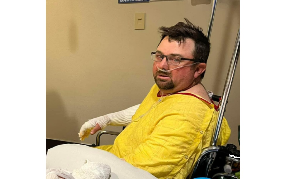 Balko Firefighter Jason Smith died Sunday from injuries he sustained in an accident battling a wildfire on April 5th.