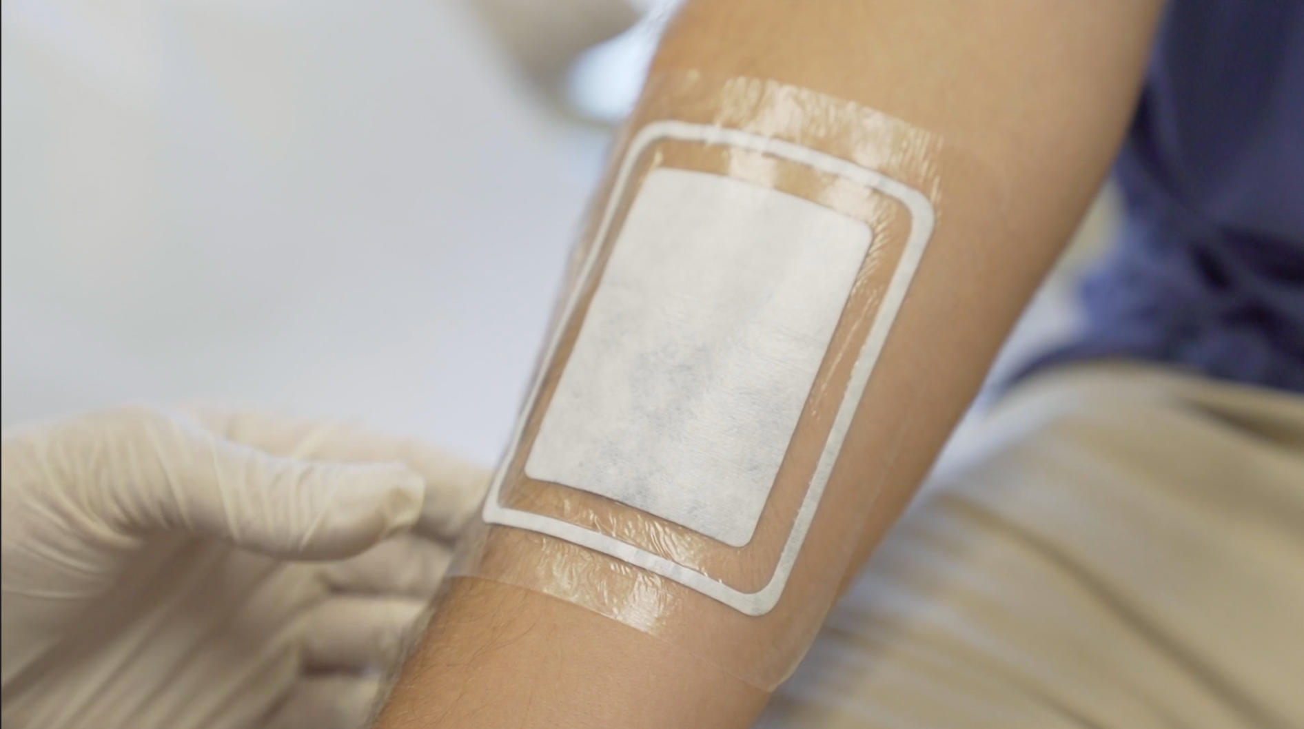 By providing first responders with a visual cue for when bandage changes are needed, DrySee helps them stay proactive in their wound care.