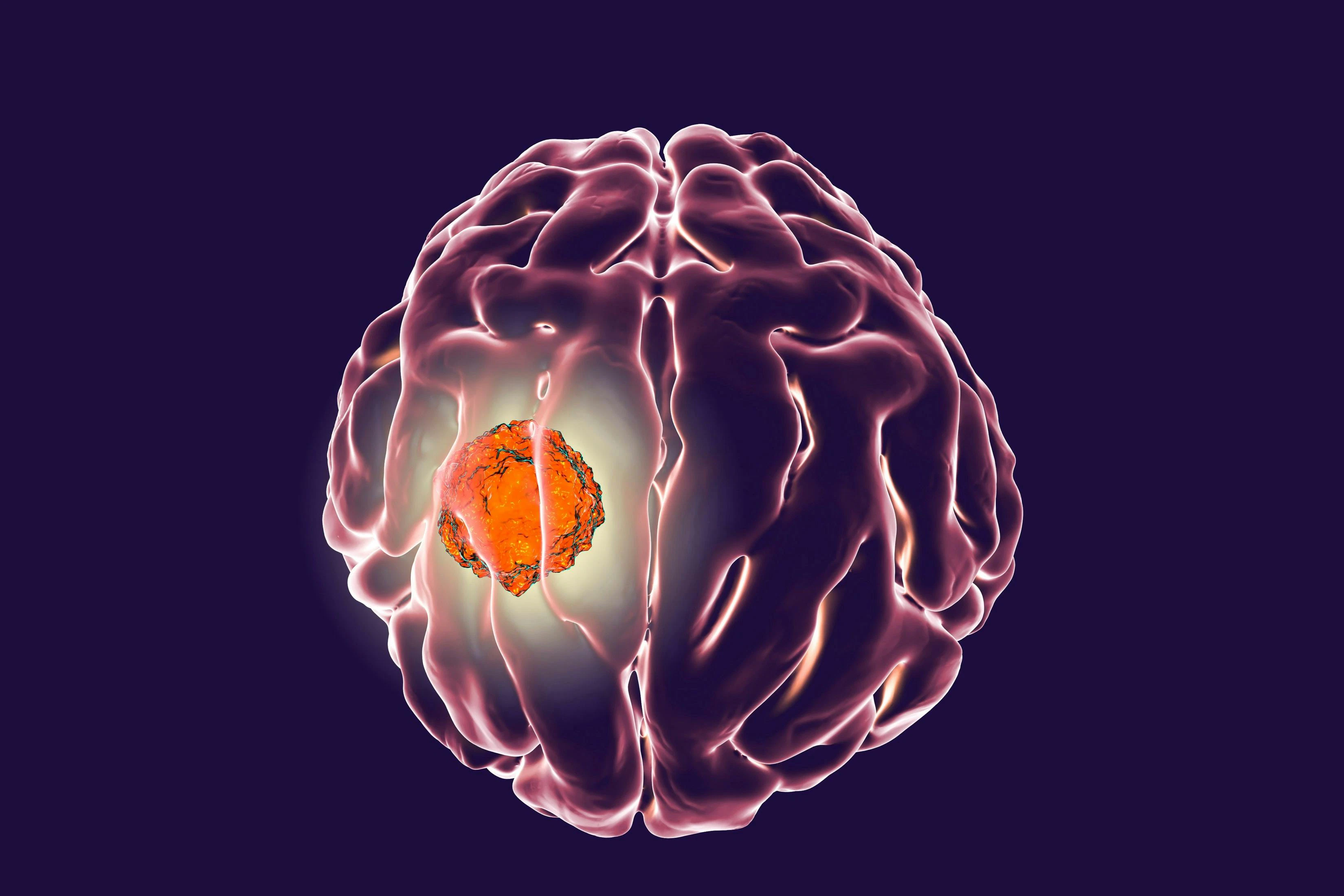 Firefighters are 1.31 times more likely to develop brain cancer than the general population is. Complacency is members' worst enemy.