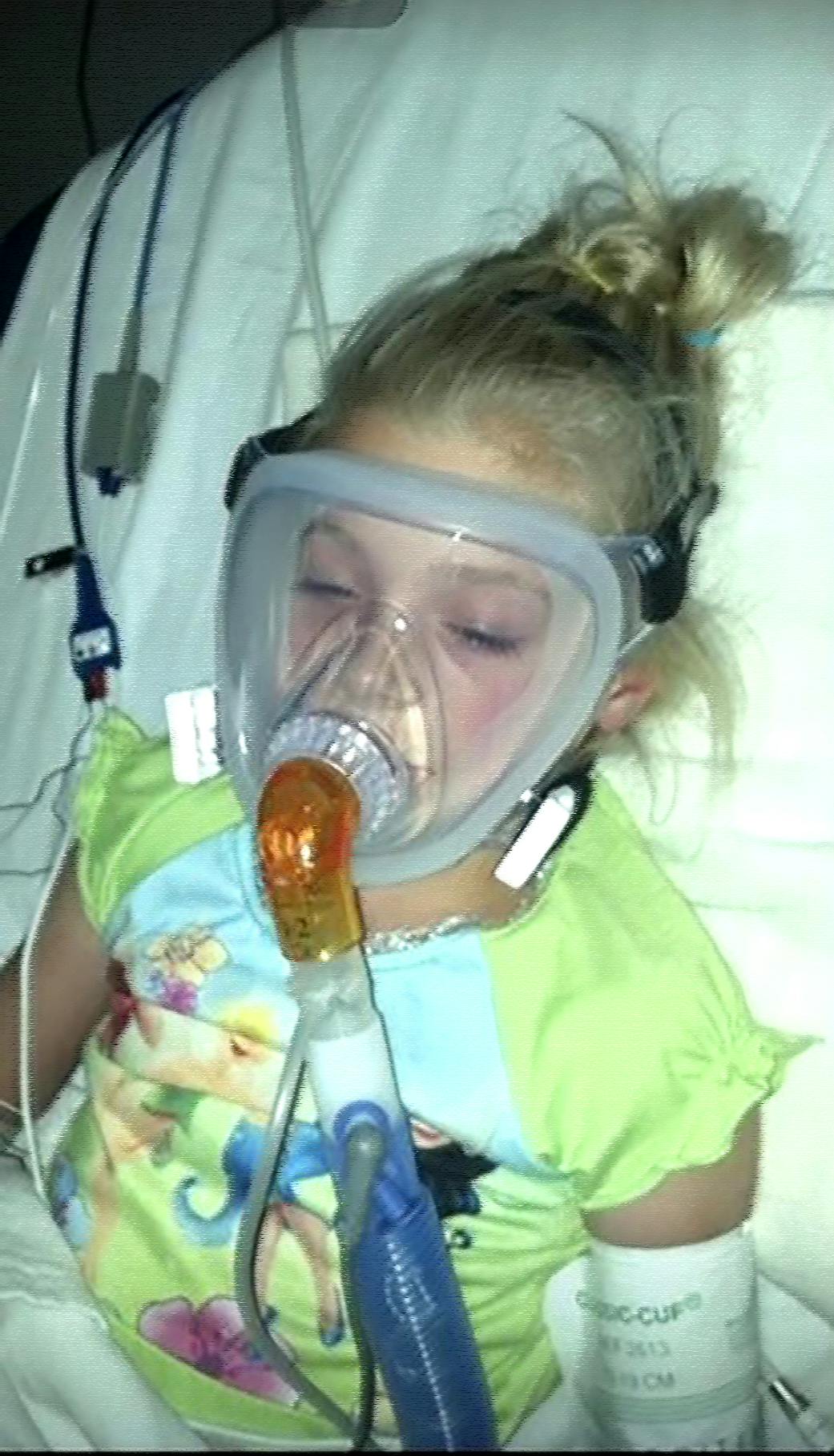 The six-year-old daughter of one of the authors went into severe distress from croup. At the hospital, the ED team prepared to intubate. The girl&rsquo;s father, who is a respiratory therapist and paramedic, asked the physician to try BiPap first. Within minutes after BiPap was employed, the girl&rsquo;s breathing stabilized. Now, pediatric CPAP is part of EMS protocols throughout the state of Ohio.