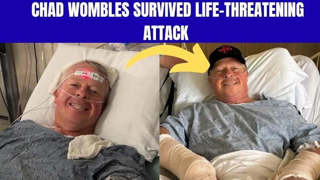 Wrightsville Firefighter Chad Wombles Recovering after Losing Hand in Sword Attack