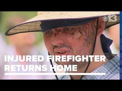 Burned Montville, ME, Firefighter Leaves Hospital to Recover at Home
